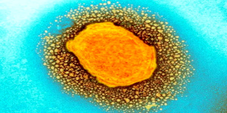 علائم بیماری آبله میمونی را بشناسید+ عکس